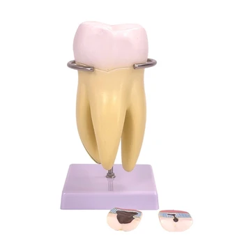 Модель анатомии зубов, модель коренных зубов Модель патологии зубов Модель человеческого зуба D5QC